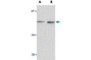 Western blot analysis of NANOS1 in rat brain tissue lysate with NANOS1 polyclonal antibody  at (A) 1 and (B) 2 ug/mL . (Nanos Homolog 1 anticorps  (Internal Region))