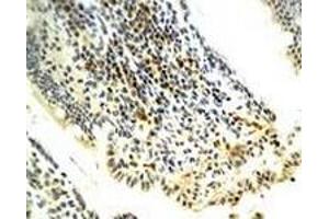 Immunohistochemiacl staining of rat model of Necrotizing Enterocolitis (NEC) tissue section with PNOC polyclonal antibody  at 1:400 dilution. (PNOC anticorps)