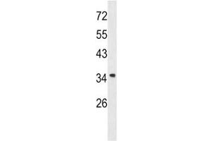 Western blot analysis of Annexin A1 antibody and A2058 lysate.
