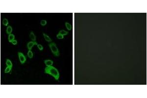 Immunofluorescence analysis of LOVO cells, using GPR139 Antibody. (GPR139 anticorps  (AA 181-230))