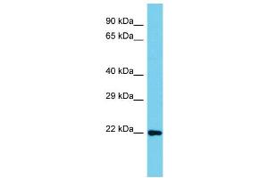 Host: Rabbit Target Name: C8orf33 Sample Type: Jurkat Whole Cell lysates Antibody Dilution: 1. (C8orf33 anticorps  (C-Term))