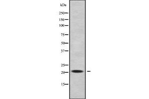 Western blot analysis of RABL5 using A549 whole cell lysates