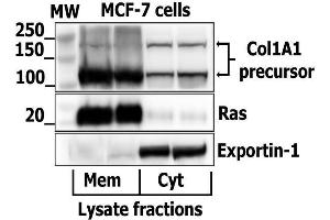 Image kindly submitted by Edita Aksamitiene as part of the Free Sample Program.