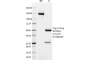 SDS-PAGE Analysis Purified BCL-6 Mouse Monoclonal Antibody (BCL6/1718). (BCL6 anticorps  (AA 256-389))