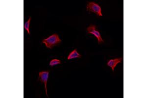 ABIN6265330 and ABIN6273170 staining Hela by IF/ICC. (STBD1 anticorps  (N-Term))
