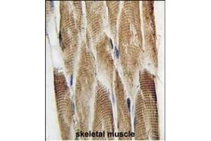 Formalin-fixed and paraffin-embedded human skeletal muscle tissue reacted with DCX Antibody  (ABIN389254 and ABIN2839395) , which was peroxidase-conjugated to the secondary antibody, followed by DAB staining.