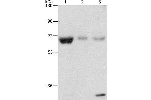 Western Blot analysis of Human fetal muscle, kidney and liver tissue using NAE1 Polyclonal Antibody at dilution of 1:500 (NAE1 anticorps)