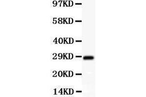 Anti-SCP3 Picoband antibody,  All lanes: Anti SCP3  at 0. (SYCP3 anticorps  (AA 18-223))