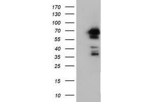 Western Blotting (WB) image for anti-Adenylate Kinase 5 (AK5) antibody (ABIN1496533) (Adenylate Kinase 5 anticorps)