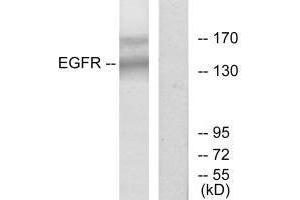 Western blot analysis of extracts from HT-29 cells, using EGFR (Ab-1172) antibody. (EGFR anticorps  (Tyr1172))