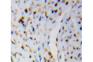 Used in DAB staining on fromalin fixed paraffin-embedded Brain tissue (HSPH1 anticorps  (AA 388-505))