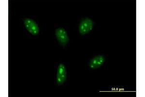 Immunofluorescence of purified MaxPab antibody to DDX24 on HeLa cell. (DDX24 anticorps  (AA 1-804))