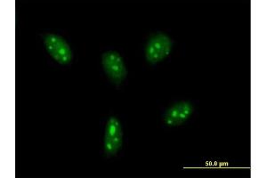 Immunofluorescence of purified MaxPab antibody to DDX24 on HeLa cell.