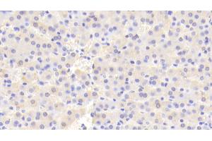 Detection of HPS4 in Human Liver Tissue using Polyclonal Antibody to Hermansky Pudlak Syndrome Protein 4 (HPS4)