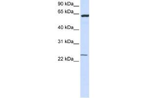 WB Suggested Anti-TMEM138 Antibody Titration:  0.