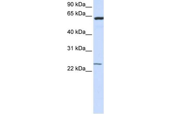TMEM138 antibody  (N-Term)