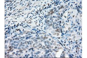 Immunohistochemical staining of paraffin-embedded colon tissue using anti-PRKYmouse monoclonal antibody. (PRKY anticorps)