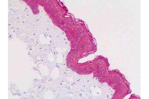 Anti-KRT5 / CK5 / Cytokeratin 5 antibody IHC staining of human skin, epidermis.