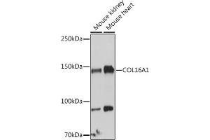 Western blot analysis of extracts of various cell lines, using COL16 antibody (8837) at 1:1000 dilution. (COL16A1 anticorps  (AA 1000-1100))
