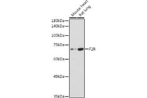 Western blot analysis of extracts of various cell lines, using F2R antibody (ABIN6132223, ABIN6140404, ABIN6140405 and ABIN6221279) at 1:1000 dilution. (PAR1 anticorps  (AA 42-110))