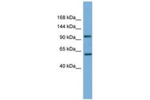 Image no. 1 for anti-Phosphatidylinositol 4-Kinase, Catalytic, beta (PI4KB) (AA 755-804) antibody (ABIN6745689) (PI4KB anticorps  (AA 755-804))