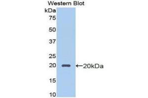 Western Blotting (WB) image for anti-Protein C Receptor, Endothelial (PROCR) (AA 63-205) antibody (ABIN1172000) (PROCR anticorps  (AA 63-205))
