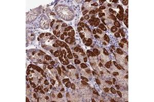 Immunohistochemical staining of human stomach with ETFDH polyclonal antibody  shows strong cytoplasmic positivity in glandular cells. (ETFDH anticorps)