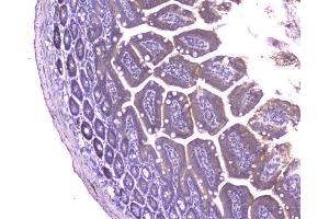 IHC analysis of CCL8 using anti-CCL8 antibody (ABIN6719605). (CCL8 anticorps  (AA 24-97))