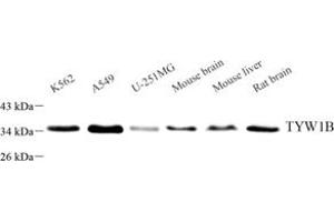 Western blot analysis of TYW1B (ABIN7076025) at dilution of 1: 3000 (TYW1B anticorps)