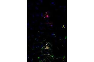 Immunofluorescence staining of P-19 mouse embryonal carcinoma cell line stimulated to neuronal differentiation by retinoic acid. (TUBB3 anticorps  (AA 441-448))