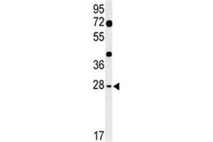 Western blot analysis of HES7 antibody and mouse heart tissue lysate.