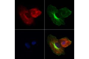 ABIN7094114 and ABIN7098158 staining Hela cells by IF/ICC. (Cathepsin L anticorps  (Internal Region))