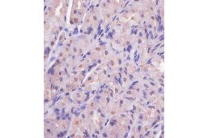 (ABIN650677 and ABIN2838644) staining EIF4E2 in human stomach tissue sections by Immunohistochemistry (IHC-P - paraformaldehyde-fixed, paraffin-embedded sections). (EIF4E2 anticorps)