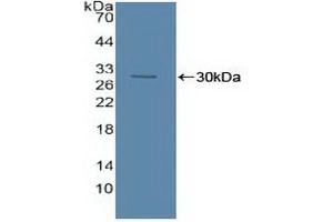 Western blot analysis of recombinant Human ASM. (SMPD1 anticorps  (AA 319-579))