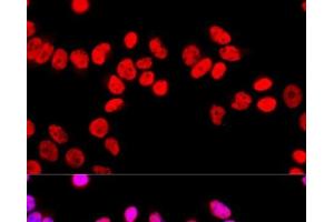 Immunofluorescence analysis of HeLa cells using SFPQ Polyclonal Antibody at dilution of 1:100 (40x lens). (SFPQ anticorps)