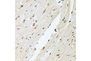 Immunohistochemistry of paraffin-embedded mouse heart using PNKP antibody (ABIN2564598) at dilution of 1:100 (40x lens). (PNKP anticorps)