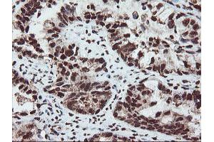 Image no. 14 for anti-SAM Domain and HD Domain 1 (SAMHD1) antibody (ABIN1500798)