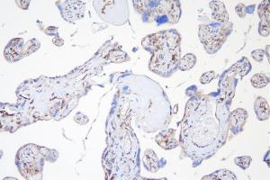 IHC analysis of APPL1 using anti-APPL1 antibody (ABIN7602658).
