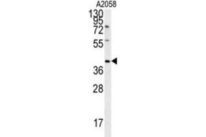 Western Blotting (WB) image for anti-CD99 Molecule-Like 2 (CD99L2) antibody (ABIN3002368) (CD99L2 anticorps)