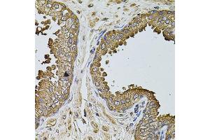 Immunohistochemistry of paraffin-embedded human prostate using MTIF3 antibody. (MTIF3 anticorps)