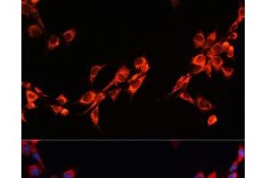 Immunofluorescence analysis of NIH/3T3 cells using PGRMC2 Polyclonal Antibody at dilution of 1:100. (PGRMC2 anticorps)