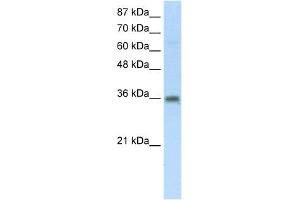 WB Suggested Anti-SFRS10 Antibody Titration:  5. (TRA2B anticorps  (Middle Region))