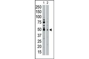 The anti-SGK2 Pab (ABIN1882131 and ABIN2842048) is used in Western blot to detect SGK2 in HeLa cell lysate (Lane 1) and mouse pancreas tissue lysate (Lane 2). (SGK2 anticorps  (N-Term))