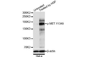 Immunofluorescence analysis of U2OS cells using Phospho-MET-Y1349 antibody (ABIN5969922). (c-MET anticorps  (pTyr1349))