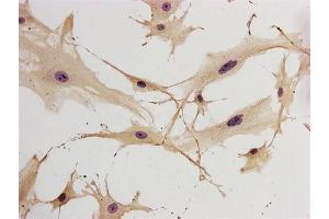 Immunohistochemistry of frozen neuroglial cells using GFAP antibody.