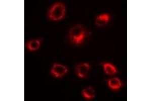 Immunofluorescent analysis of Serpin A10 staining in HepG2 cells. (SERPINA10 anticorps)