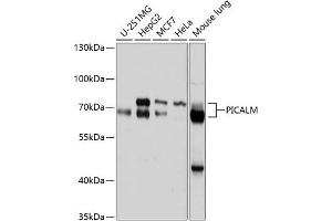 Western blot analysis of extracts of various cell lines, using PICALM antibody (ABIN6132898, ABIN6145606, ABIN6145607 and ABIN6214874) at 1:1000 dilution. (PICALM anticorps  (AA 290-460))