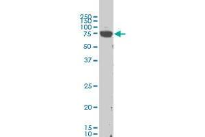 LIMK1 monoclonal antibody (M02), clone 1B2 Western Blot analysis of LIMK1 expression in Hela S3 NE .