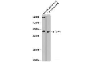 Western blot analysis of extracts of various cell lines using STMN4 Polyclonal Antibody at dilution of 1:1000. (STMN4 anticorps)