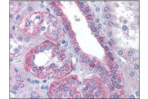 Human Kidney: Formalin-Fixed, Paraffin-Embedded (FFPE) (Flotillin 2 anticorps  (C-Term))
